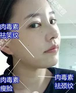 https://img.miyanlife.com/mnt/timg/180507/11563414Z-1.jpg