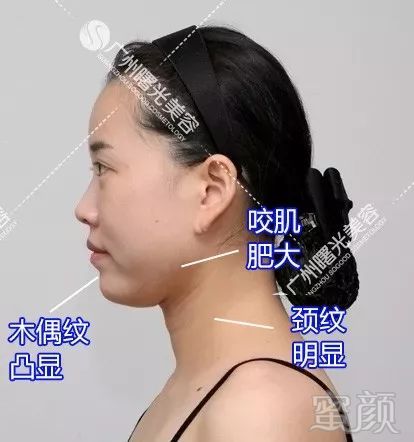 https://img.miyanlife.com/mnt/timg/180507/1156343S0-0.jpg