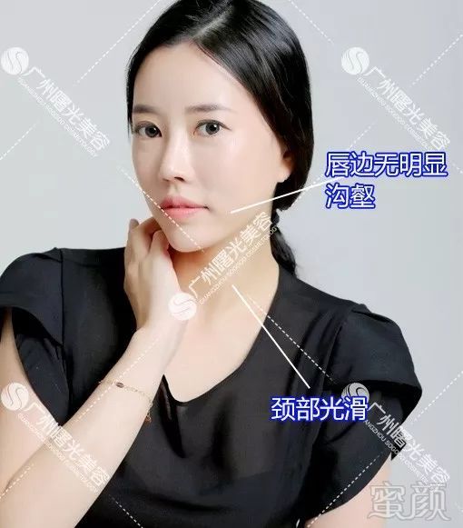 https://img.miyanlife.com/mnt/timg/180507/1156351911-6.jpg