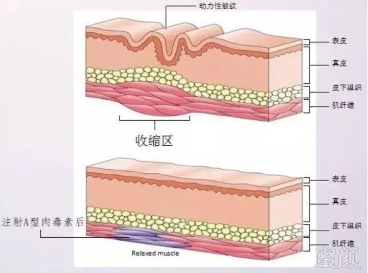 https://img.miyanlife.com/mnt/timg/180507/1156355295-3.jpg