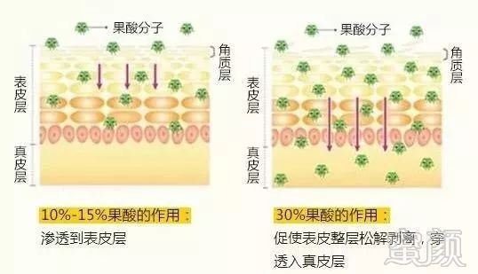 案例图片