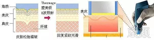 案例图片