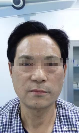 https://img.miyanlife.com/mnt/timg/180507/1220093a8-10.jpg