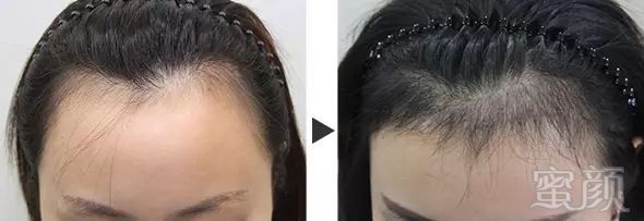 https://img.miyanlife.com/mnt/timg/180508/1044194b1-7.jpg