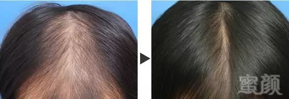 https://img.miyanlife.com/mnt/timg/180508/10441T459-4.jpg