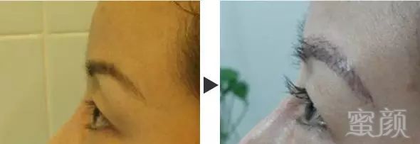 https://img.miyanlife.com/mnt/timg/180508/1044205413-11.jpg