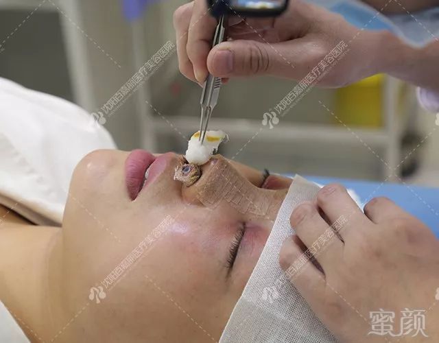 https://img.miyanlife.com/mnt/timg/180508/10503250X-2.jpg