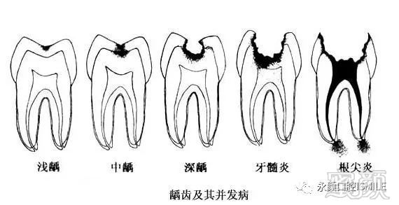 案例图片