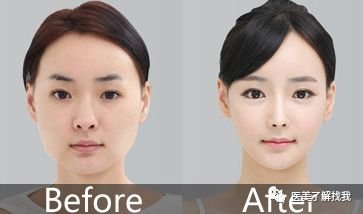 https://img.miyanlife.com/mnt/timg/180508/1052423405-3.jpg