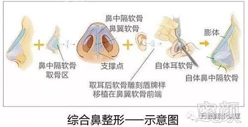 https://img.miyanlife.com/mnt/timg/180508/1055021150-3.jpg