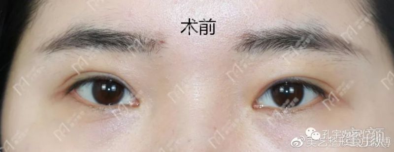 https://img.miyanlife.com/mnt/timg/180508/1106263L0-0.jpg