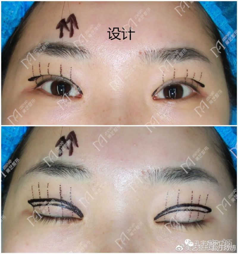 https://img.miyanlife.com/mnt/timg/180508/11062G918-1.jpg
