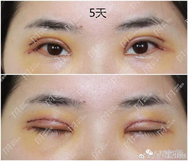 https://img.miyanlife.com/mnt/timg/180508/11062J002-2.jpg