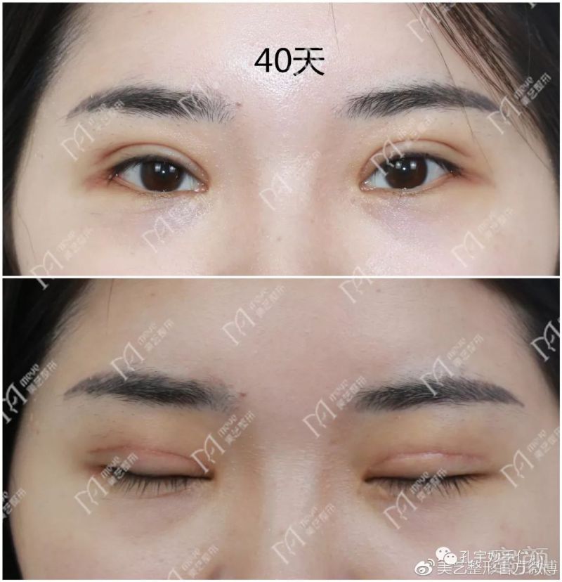 https://img.miyanlife.com/mnt/timg/180508/11062U429-3.jpg
