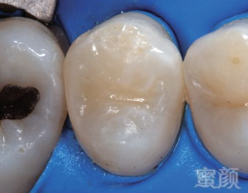 案例图片