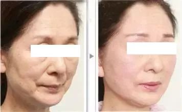 https://img.miyanlife.com/mnt/timg/180508/1126122F7-4.jpg