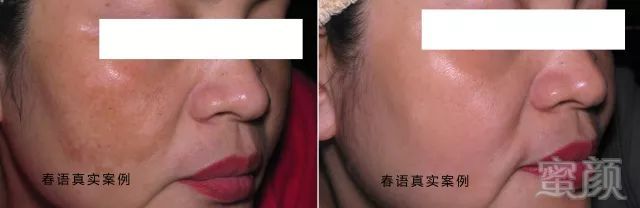 https://img.miyanlife.com/mnt/timg/180508/112613KR-9.jpg