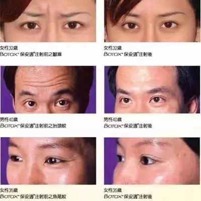 https://img.miyanlife.com/mnt/timg/180508/11344415P-6.jpg