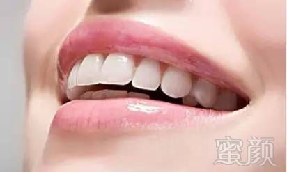 https://img.miyanlife.com/mnt/timg/180508/113U9B05-0.jpg