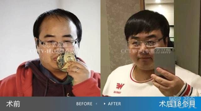 https://img.miyanlife.com/mnt/timg/180508/121FL023-0.jpg