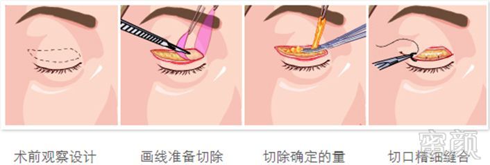https://img.miyanlife.com/mnt/timg/180508/1225545B2-4.jpg