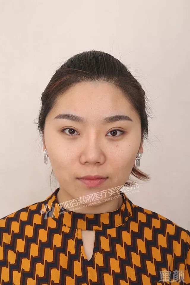 https://img.miyanlife.com/mnt/timg/180509/105G25929-1.jpg