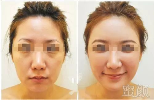 https://img.miyanlife.com/mnt/timg/180509/11111aM0-9.jpg