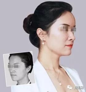 https://img.miyanlife.com/mnt/timg/180509/111205OE-3.jpg