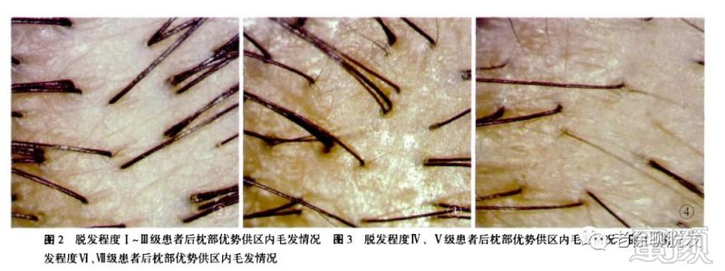 https://img.miyanlife.com/mnt/timg/180509/1119251622-4.jpg