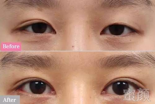 https://img.miyanlife.com/mnt/timg/180509/112G413U-7.jpg