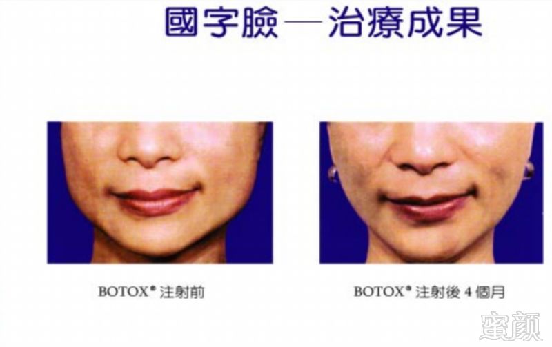 https://img.miyanlife.com/mnt/timg/180509/114124H01-4.jpg