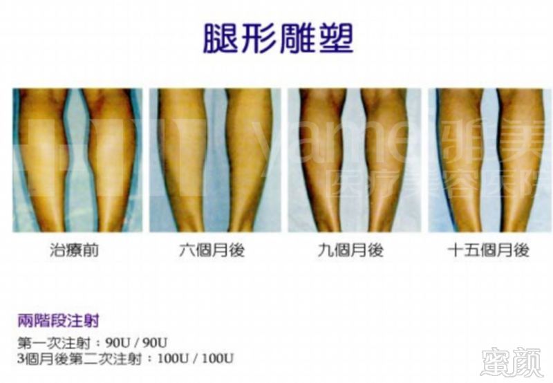 https://img.miyanlife.com/mnt/timg/180509/11412K411-5.jpg