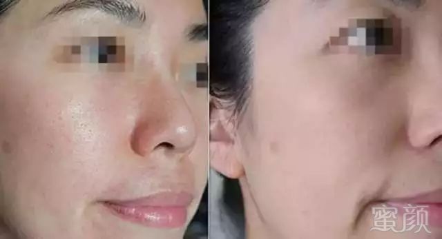 https://img.miyanlife.com/mnt/timg/180509/114941O58-6.jpg