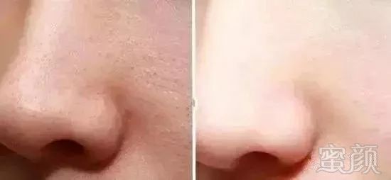 https://img.miyanlife.com/mnt/timg/180509/114943IG-11.jpg