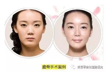 https://img.miyanlife.com/mnt/timg/180510/1125442358-1.jpg