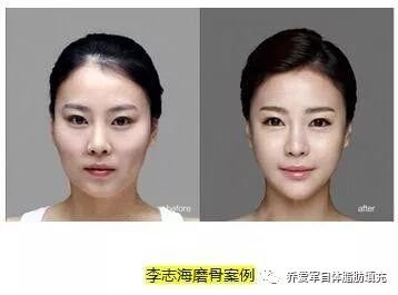 https://img.miyanlife.com/mnt/timg/180510/112545B18-4.jpg