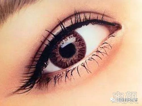 https://img.miyanlife.com/mnt/timg/180510/1132341028-0.jpg