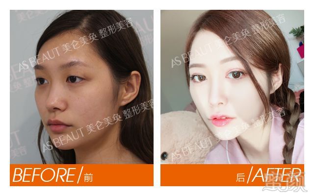 https://img.miyanlife.com/mnt/timg/180510/113P25012-6.jpg