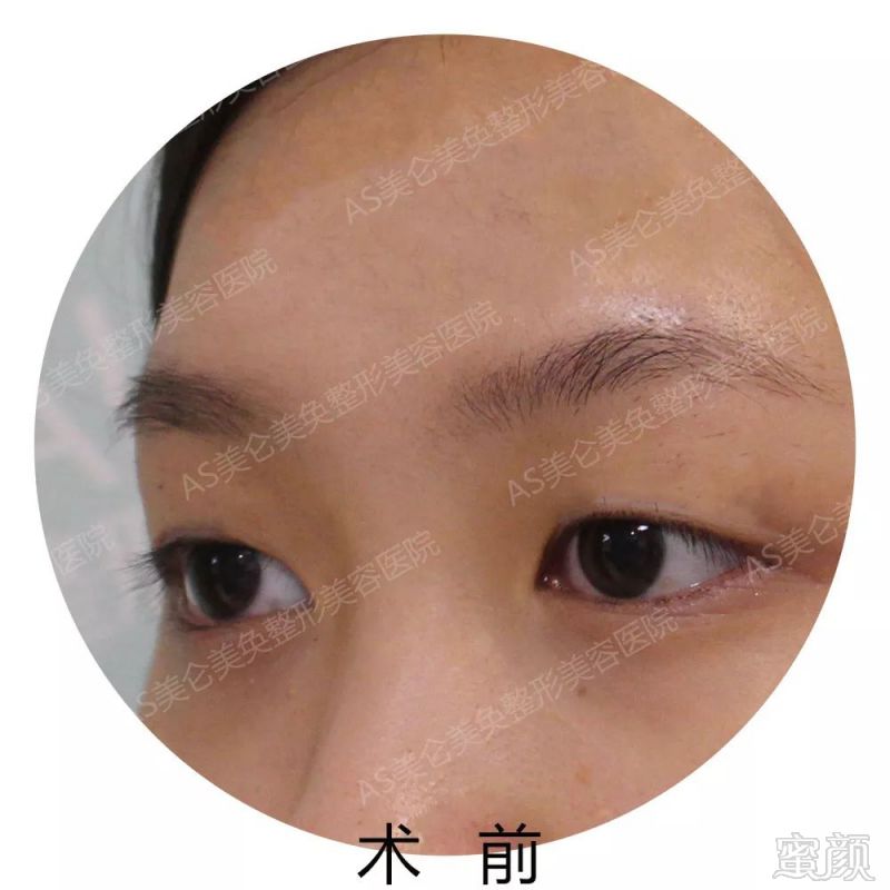 https://img.miyanlife.com/mnt/timg/180510/113P31P5-8.jpg