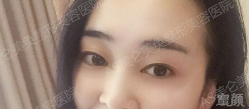 https://img.miyanlife.com/mnt/timg/180510/113P52511-14.jpg