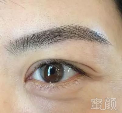 https://img.miyanlife.com/mnt/timg/180510/1140444609-8.jpg