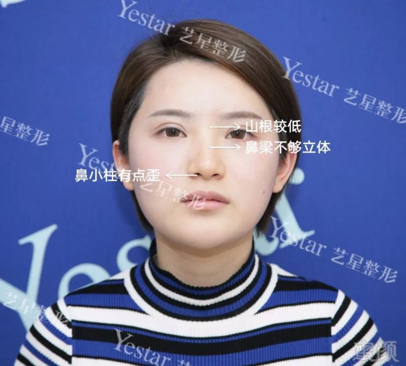 https://img.miyanlife.com/mnt/timg/180510/1141004H7-2.jpg