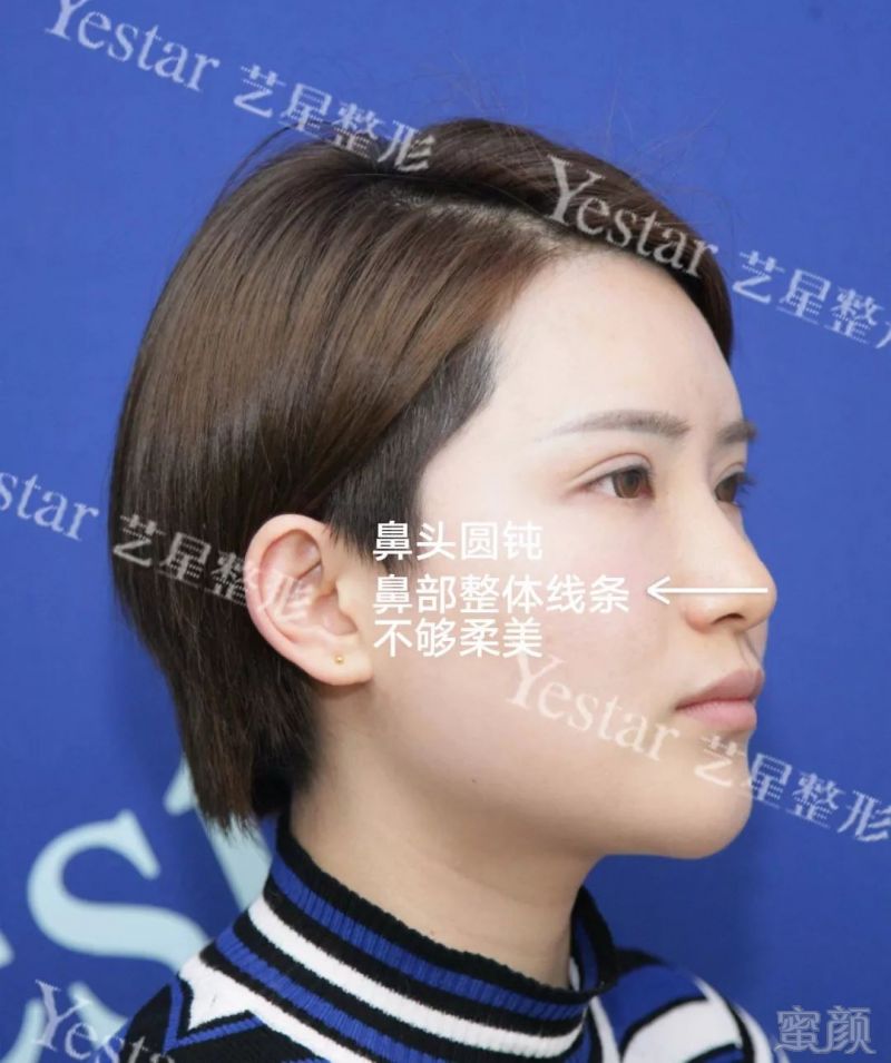 https://img.miyanlife.com/mnt/timg/180510/1141013295-3.jpg