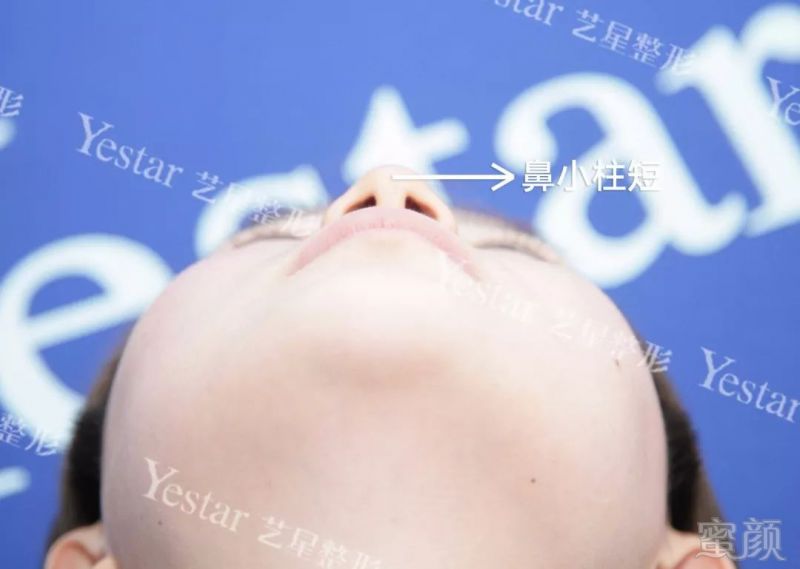 https://img.miyanlife.com/mnt/timg/180510/114102N44-4.jpg