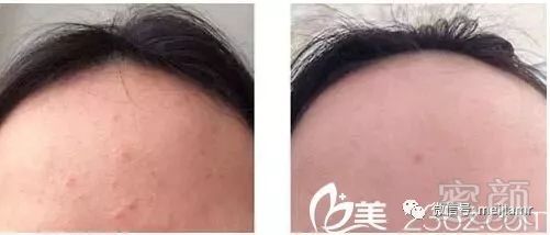 https://img.miyanlife.com/mnt/timg/180510/1153144Y8-0.jpg