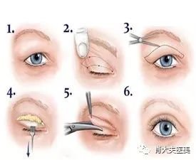 https://img.miyanlife.com/mnt/timg/180510/1209101264-1.jpg
