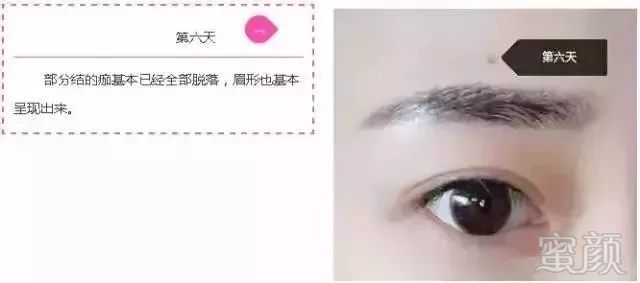 https://img.miyanlife.com/mnt/timg/180510/1213552593-13.jpg