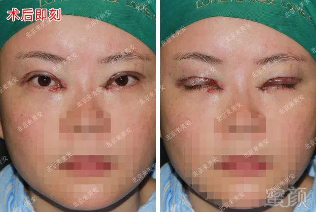https://img.miyanlife.com/mnt/timg/180510/122021CY-4.jpg