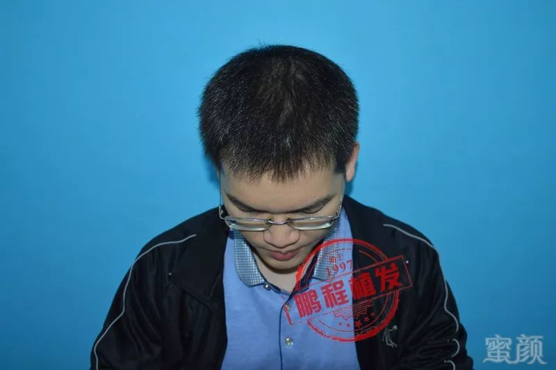 https://img.miyanlife.com/mnt/timg/180510/12344QE1-6.jpg