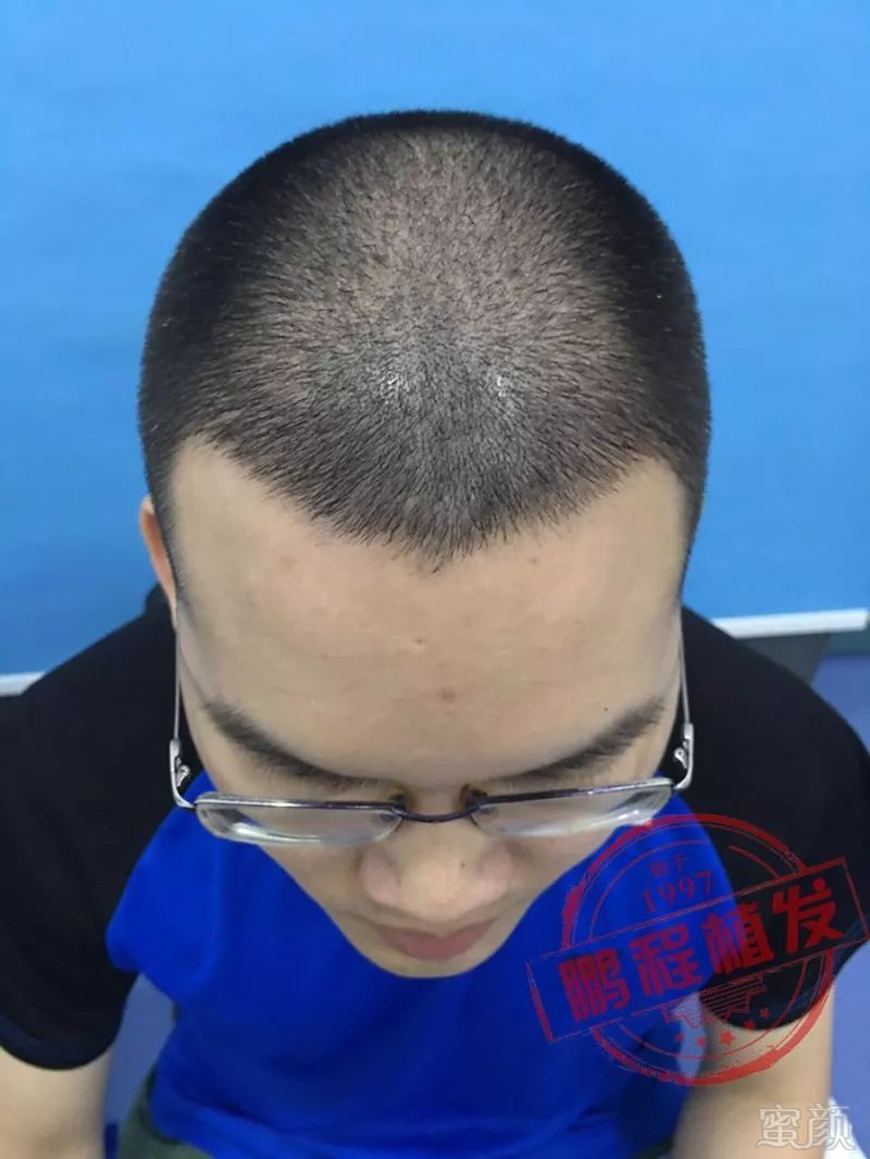 https://img.miyanlife.com/mnt/timg/180510/12344S2J-5.jpg